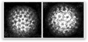 Depiction of the effects of using a heavy metal salt solution to negatively stain particles on a carbon film. The stain (dark) pools around the particles (light).  Human rotavirus particles, stained from below (left) and by immersion (right). Images copyright LM Stannard 