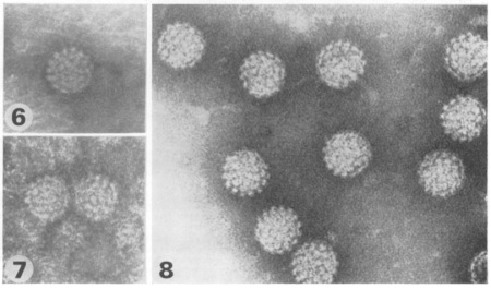 Virus particles from genital warts (6 &7) and a common skin wart (8).  Reproduced from Brit. J. vener. Dis., JD Oriel and JD Almeida, 46, 37-42, 1970 with permission from BMJ Publishing Group Ltd.